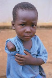 Rebelové usekali ruce a nohy tisícům Sierraleoňanů.