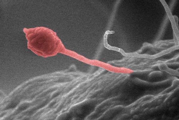Houba Gliocladium roseum umí z celulózy vyrobit bionaftu.