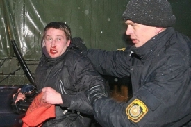 Andrej Ljankevič poté co ho zmlátila běloruská milice.