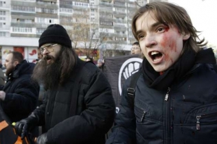Zkrvavělý protikremelský demonstrant.