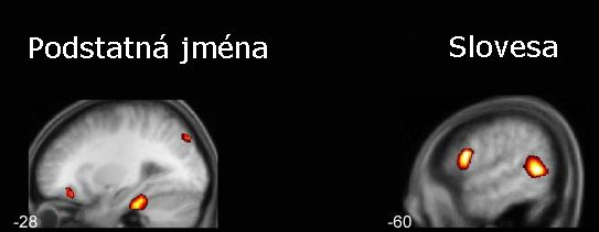 Funkční magnetická rezonance odhalila rozdíly mezi slovními druhy.
