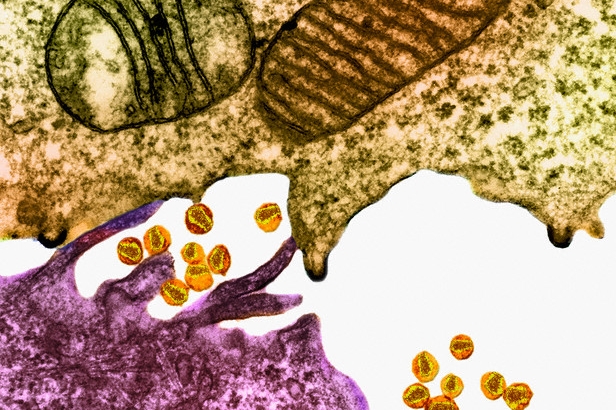 Virus HIV.
